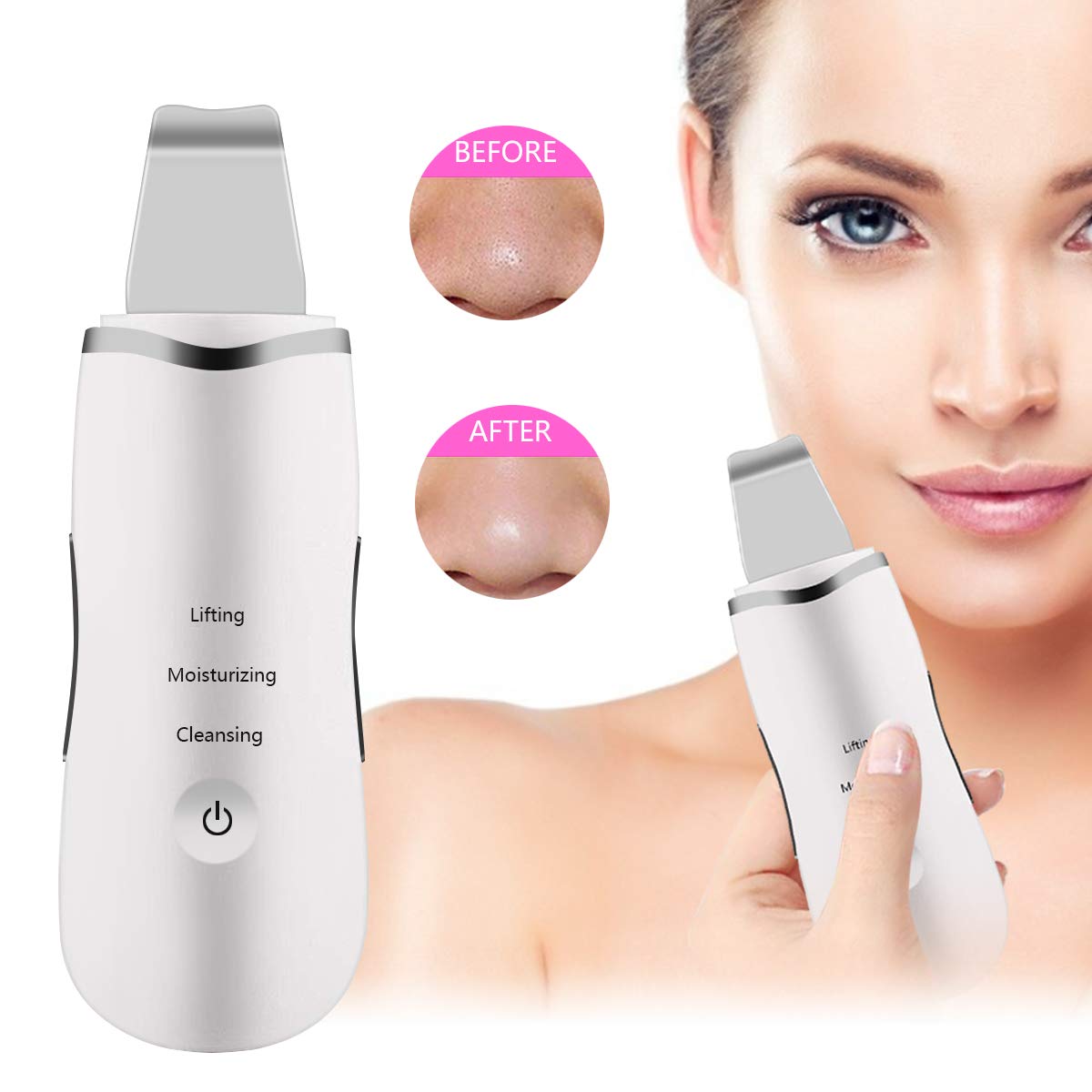 💞LIMPIEZA Y NUTRICIÓN FACIAL ULTRASÓNICA